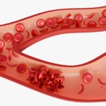 Seglcelleanæmi (SCD) – symptomer, årsager og behandling