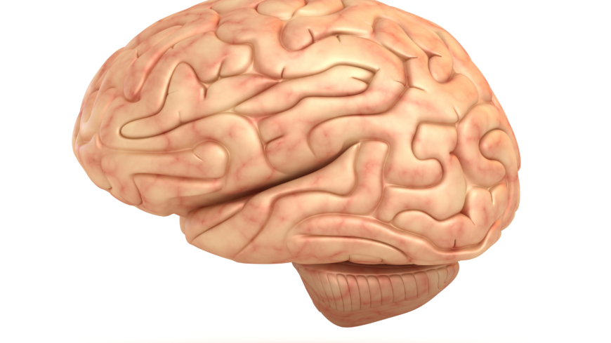 En hjernerystelse skyldes et slag mod hovedet og kan forårsage kvalme.