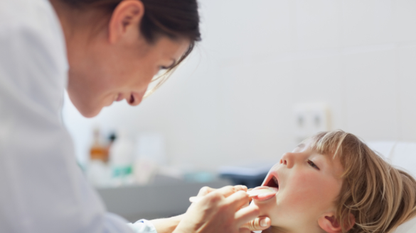 Halsbetændelse (bakteriel tonsillitis)