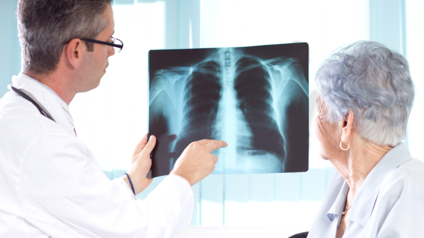 Tuberkulose er en infektionssygdom, som mest påvirker lungerne. 