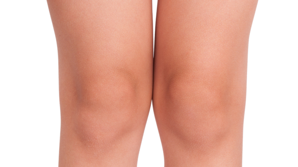 Slatterknæ (Schlatters sygdom) Hvad er det og hvordan opstår det.