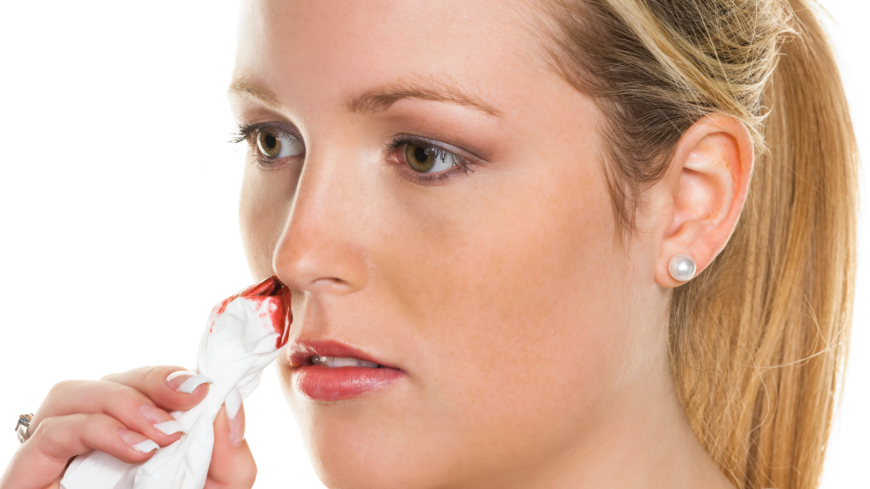 Næseblod skyldes at næseskillevæggens ydre blodkar brister. 