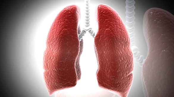 Sarkoidose (Schaumanns sygdom) symptomer og diagnosticering