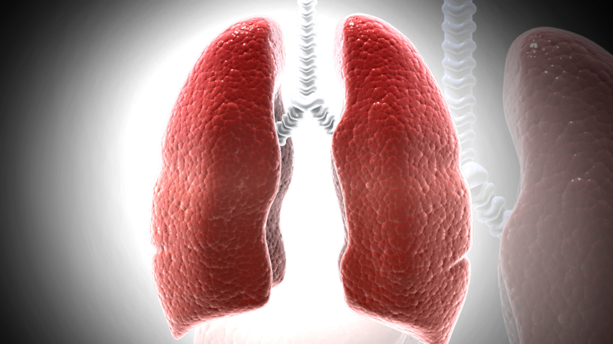 Sarkoidose er en infektion, som oftest rammer lungerne