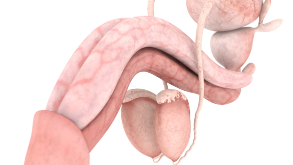 Testikelvridning (torsio testis) hurtig behandling nødvendig