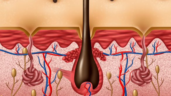 Eksem. Typer og behandling.