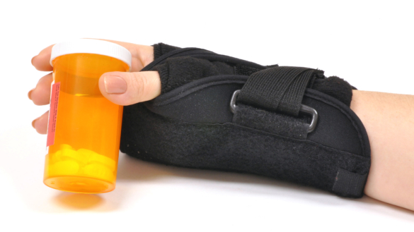 Karpaltunnelsyndrom. Hvad er det og hvad kan der gøres