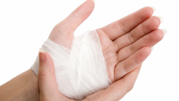 Klemt finger. Skal det behandles?