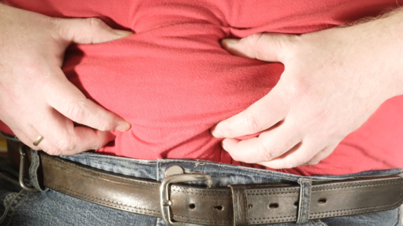 Overvægt og fedme (adipositas) Hjælp til overvægt