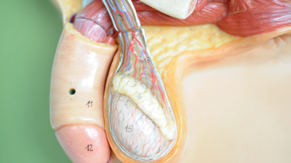 Klinefelters syndrom. Hvordan opdages sygdommen og hvordan behandles den.